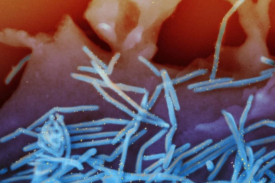 Una micrografía electrónica en color muestra viriones del virus respiratorio sincitial humano (VRS) desprendidos de células epiteliales pulmonares humanas. (NIAID a través de The Epoch Times).