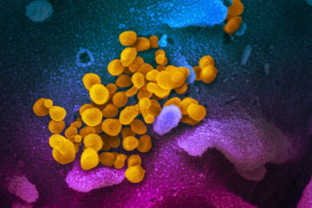 Esta imagen tomada con un microscopio electrónico de barrido muestra el virus que causa el COVID-19 aislado de un paciente en Estados Unidos, emergiendo de la superficie de células (azul/rosa) cultivadas en el laboratorio. (NIAID-RML/CC BY 2.0)