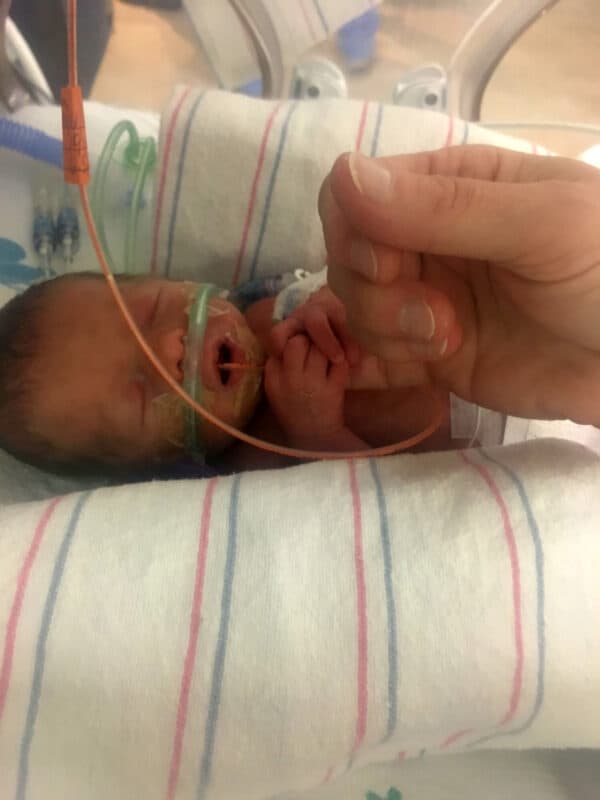 Jayden en la unidad de cuidados intensivos neonatales. (SWNS)