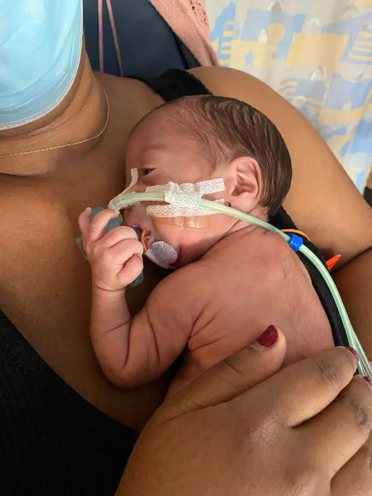 Ozzy estuvo en la UCIN los tres primeros meses de su vida. (Cortesía de Suzy Mack)