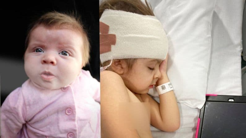 Evie-Mae Geurts, ciega de nacimiento, cuando era un bebé y más tarde en el hospital cuando era niña. (SWNS)