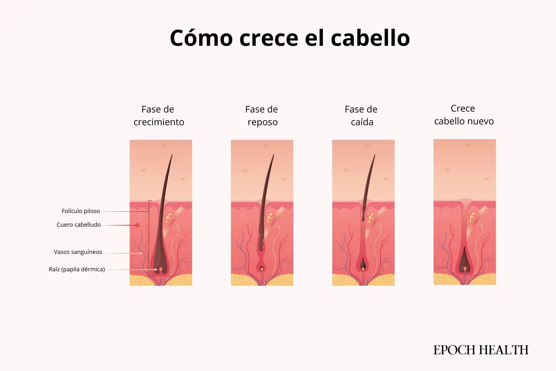 El cabello crece en ciclos, comenzando con una fase de crecimiento de dos a siete años, seguida de una fase de reposo, caída y recrecimiento. (Ilustración de The Epoch Times, Shutterstock).