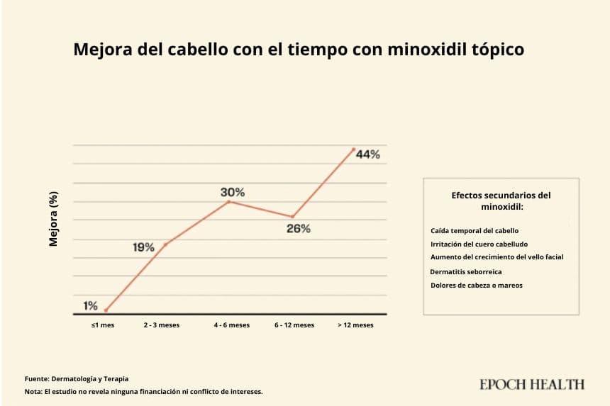 Después de más de un año de uso, el 44 % de los pacientes que persistieron con el tratamiento tópico con minoxidil reportaron una notable mejora en el crecimiento del cabello. (The Epoch Times)