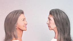 "Ozempic Face": Cuando perder peso te envejece más rápido