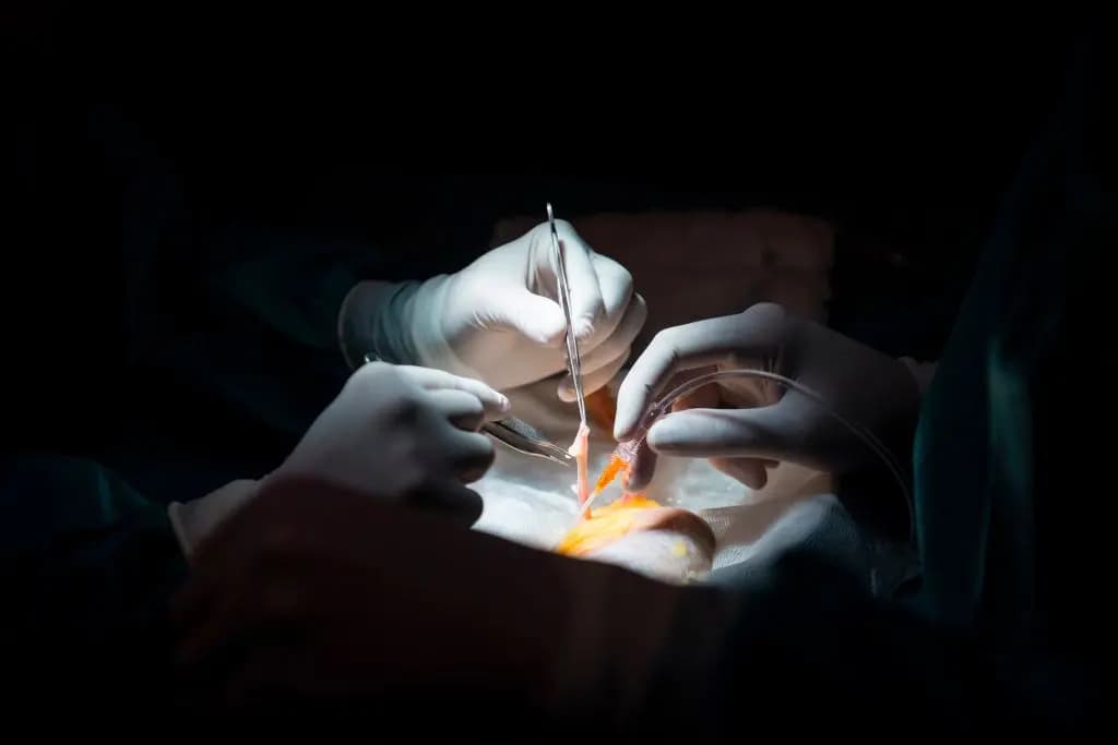 Los médicos se preparan para un trasplante de riñón, en esta foto de archivo. (Pierre-Philippe Marcou/AFP/Getty Images)