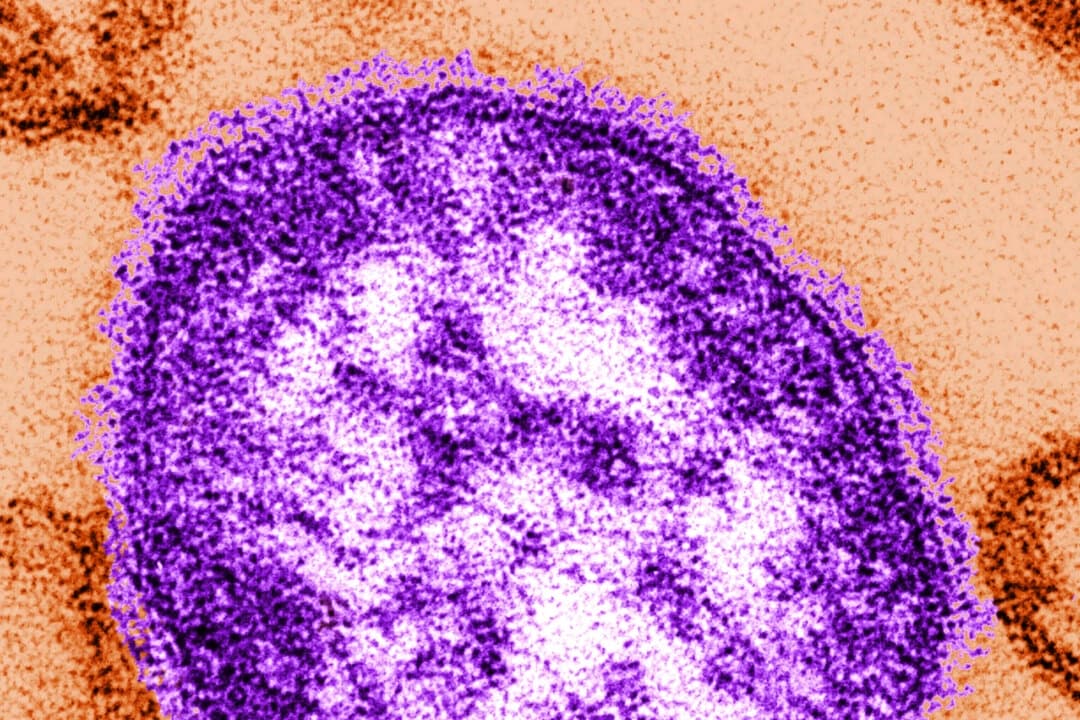 Imagen de una partícula del virus del sarampión obtenida mediante un microscopio electrónico, proporcionada por los Centros para el Control y la Prevención de Enfermedades el 4 de febrero de 2015. (Cynthia Goldsmith/Centros para el Control y la Prevención de Enfermedades vía AP)