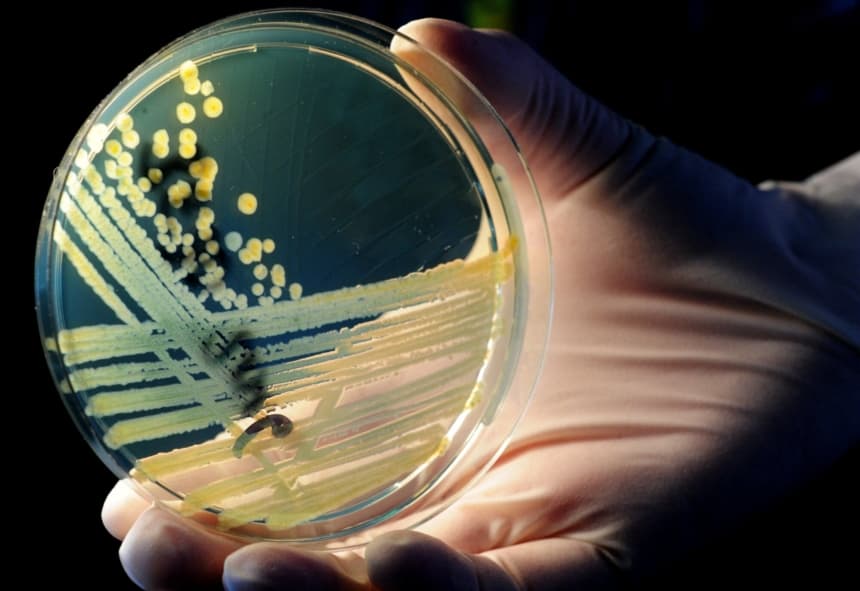 Un trabajador de laboratorio sostiene una placa de Petri con colonias de E. coli enterohemorrágica (EHEC) en un medio de cultivo en el departamento de salud pública de Baja Sajonia en Hannover, norte de Alemania, el 23 de mayo de 2011. (JULIAN STRATENSCHULTE,-/DPA/AFP via Getty Images)