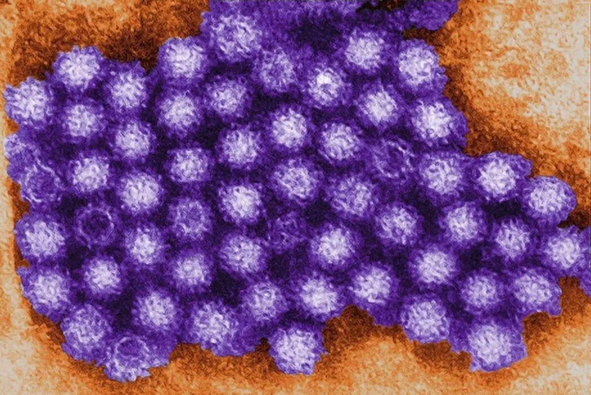 <em>Una micrografía electrónica de transmisión muestra partículas de norovirus en esta foto de archivo. (Charles D. Humphrey/Centros para el Control y la Prevención de Enfermedades)</em>