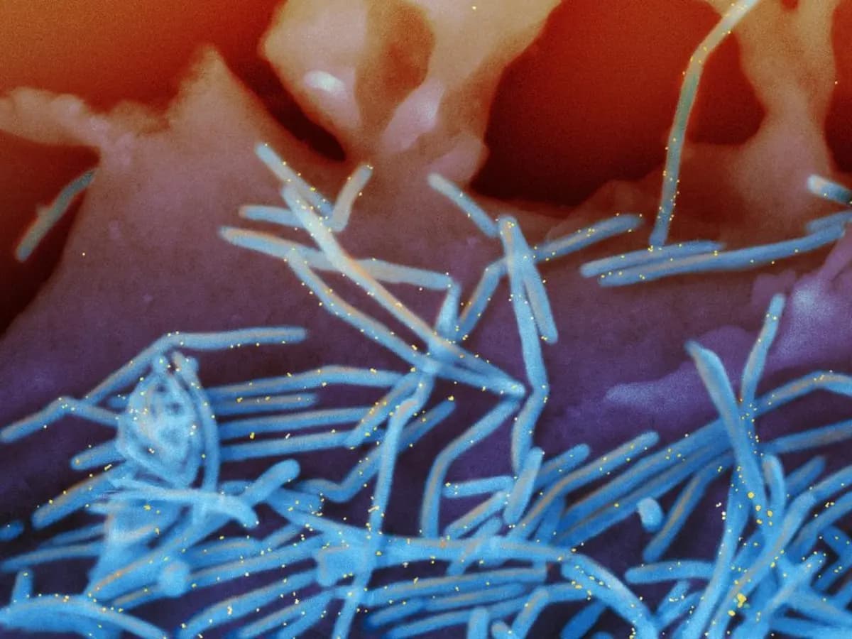 <em>Una micrografía electrónica de barrido coloreada muestra viriones del virus respiratorio sincitial (VRS) humano desprendiéndose de células epiteliales pulmonares humanas. (NIAID vía The Epoch Times).</em>