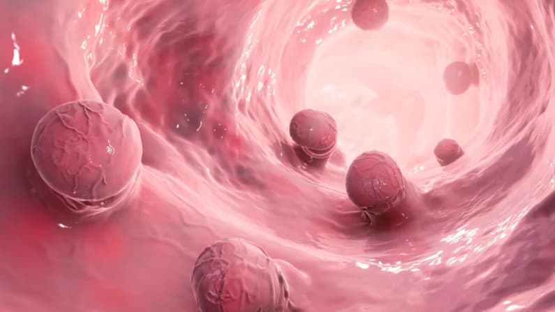 Rigidez del colon por inflamación crónica dispara casos de cáncer en adultos jóvenes
