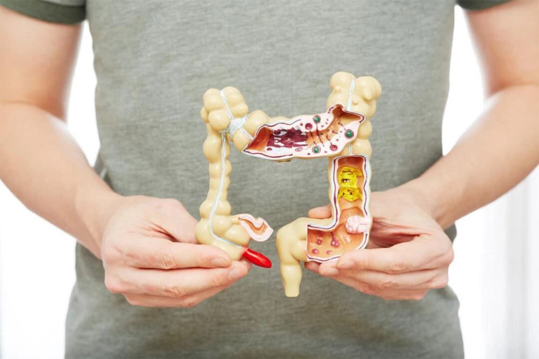 El estreñimiento puede provocar enfermedades como el cáncer colorrectal. Existen prácticas cotidianas sencillas pero efectivas para ayudar a mejorarlo. (Peakstock/Shutterstock)