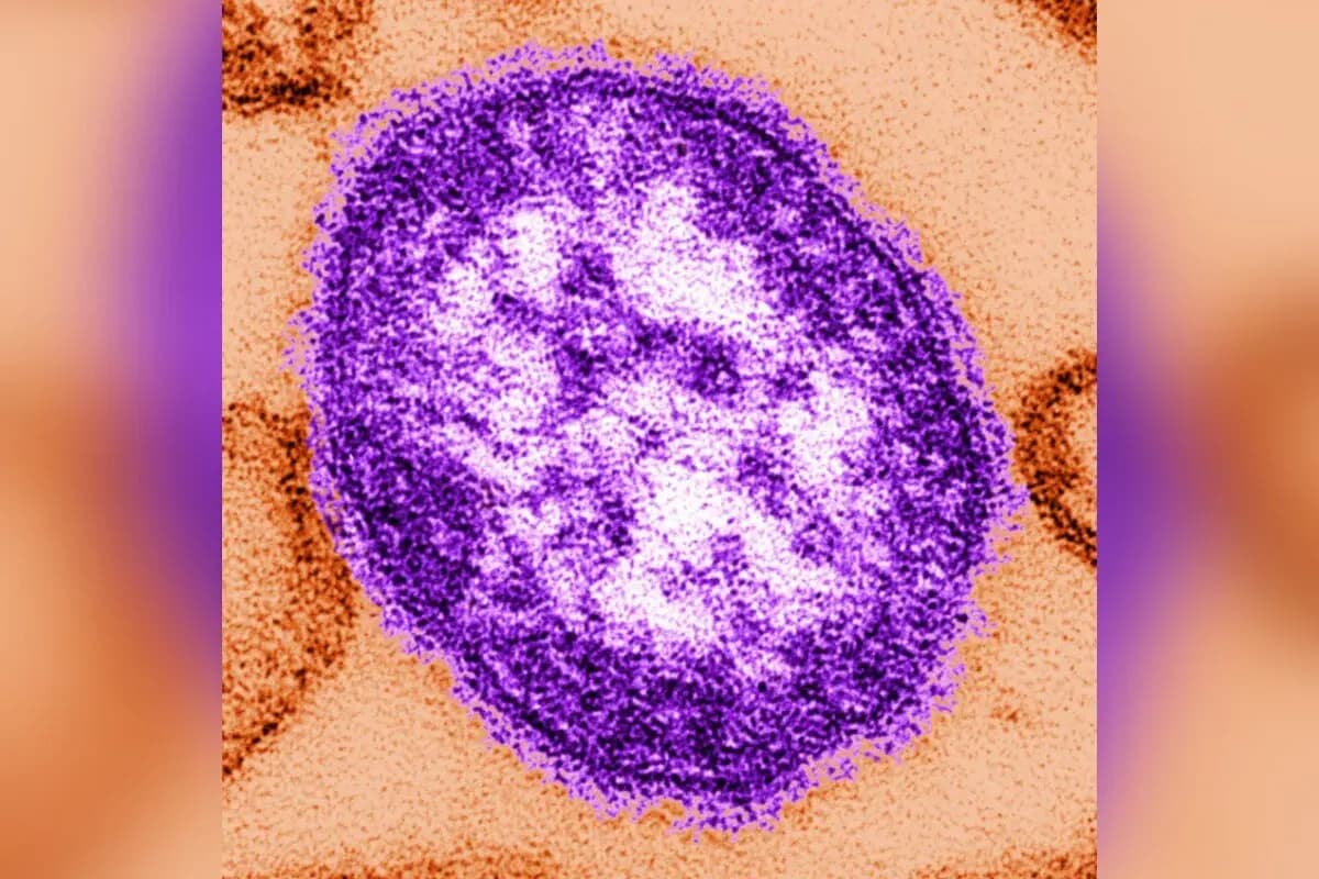 Esta imagen sin fecha, proporcionada por los Centros para el Control y la Prevención de Enfermedades el 4 de febrero de 2015, muestra una imagen de microscopio electrónico de una partícula del virus del sarampión (centro). (The Canadian Press/AP-Cynthia Goldsmith/Centros para el Control y la Prevención de Enfermedades vía AP).