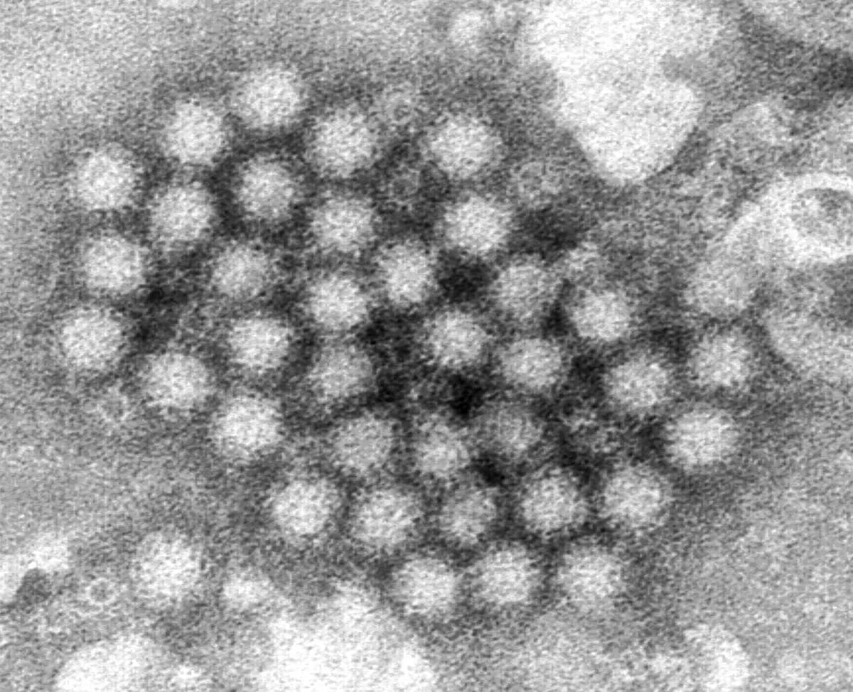 <em>Esta imagen de microscopio electrónico, proporcionada por los Centros para el Control y la Prevención de Enfermedades, muestra un grupo de viriones de norovirus. (Charles D. Humphrey/CDC vía AP)</em>