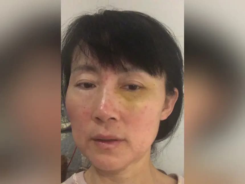 Zhang Chunping, practicante de Falun Gong que fue agredida en Londres el 23 de febrero de 2026. (Cortesía de Zhang Chunping)