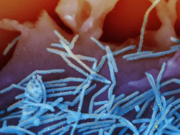 Una micrografía electrónica de barrido coloreada muestra viriones del virus sincitial respiratorio humano (VSR) desprendiéndose de células epiteliales pulmonares humanas. (NIAID vía The Epoch Times).