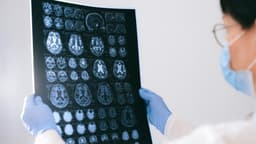 Una bacteria común podría empeorar el Alzheimer