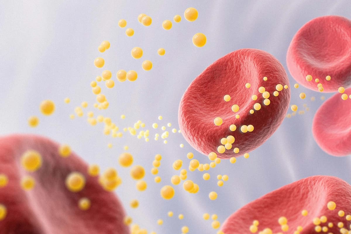Imagen de colesterol en la sangre. (Anusorn Nakdee/Shutterstock).