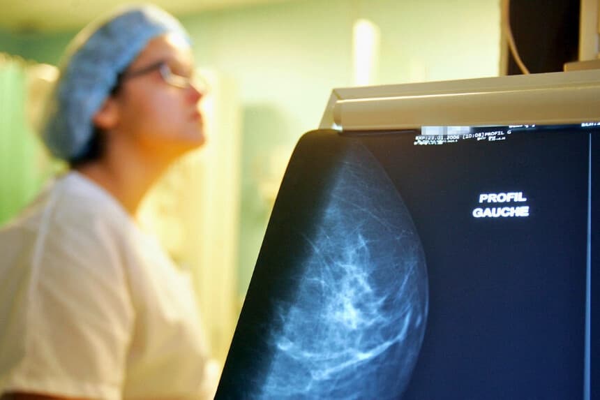 Fotografía tomada durante una macrobiopsia guiada por mamotomo a una paciente que presentaba lesiones detectadas en una mamografía, en el Instituto Curie de París, el 8 de marzo de 2006. (Joel Saget/AFP vía Getty Images).