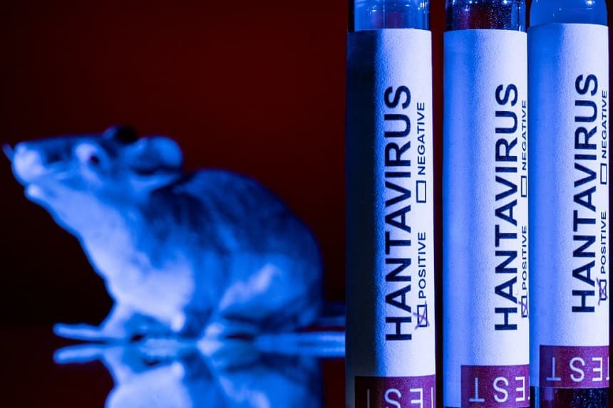 Esta fotografía, tomada en París el 11 de mayo de 2026, muestra viales con la inscripción “hantivirus”. (Joel Saget / AFP vía Getty Images)