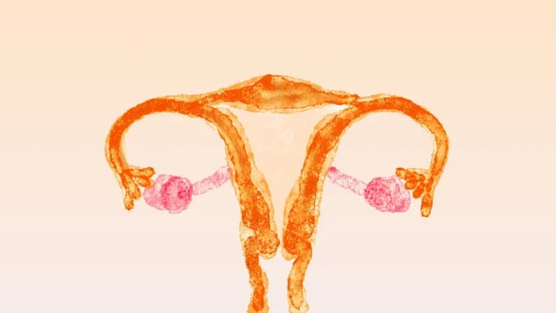 SOP: Una de las afecciones femeninas más incomprendidas ahora cambia de nombre