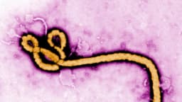 Estados Unidos emite advertencias de viaje por el brote de ébola en el Congo
