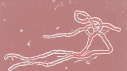 El virus del Ébola es mortal, pero he aquí por qué no debe preocuparse