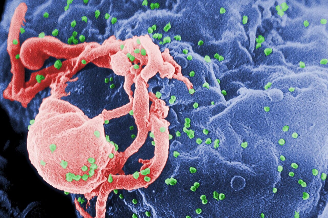 Microfotografía con MEB de VIH-1 en liberación (en verde) en un cultivo de linfocitos. Esta imagen ha sido coloreada para resaltar las características importantes; para la imagen original en blanco y negro véase PHIL 1197. Las múltiples protuberancias redondeadas sobre la superficie celular representa los sitios de ensamblado y gemación de viriones. (Foto: C. Goldsmith/CDC)