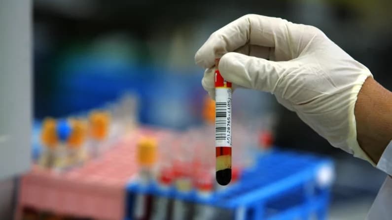 Sociedad Americana contra el Cáncer dice que análisis de sangre es una opción para el cáncer de colon y recto