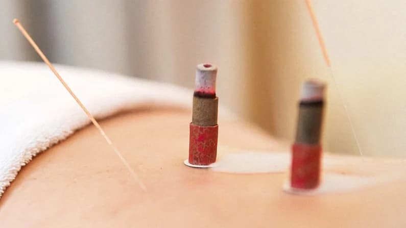 Insuficiencia ovárica prematura: cómo la medicina tradicional china puede ayudar