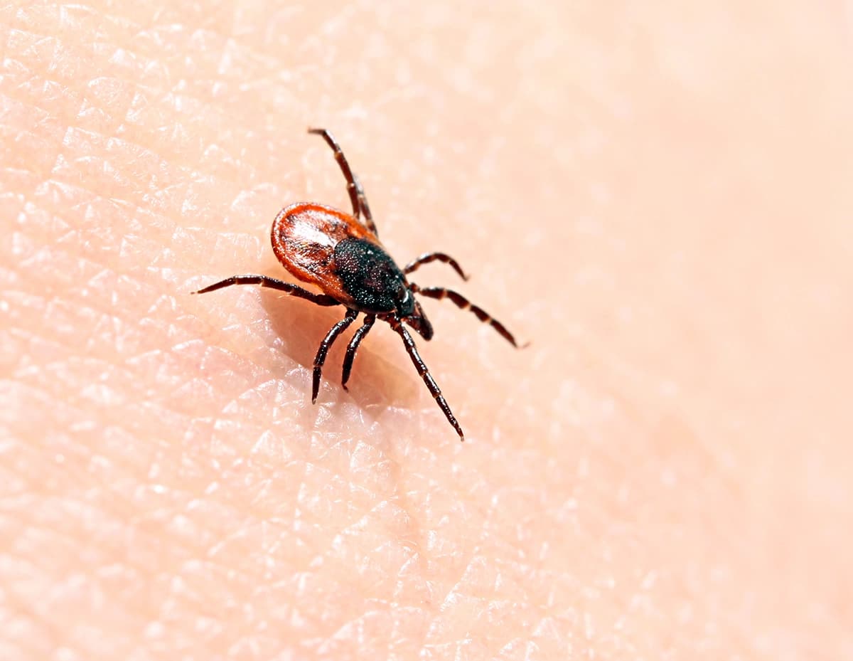 Garrapatas en la piel humana. La especie Ixodes ricinus puede transmitir patógenos tanto bacterianos como virales, como los agentes causantes de la enfermedad de Lyme y la encefalitis transmitida por garrapatas. (daksel/Shutterstock)