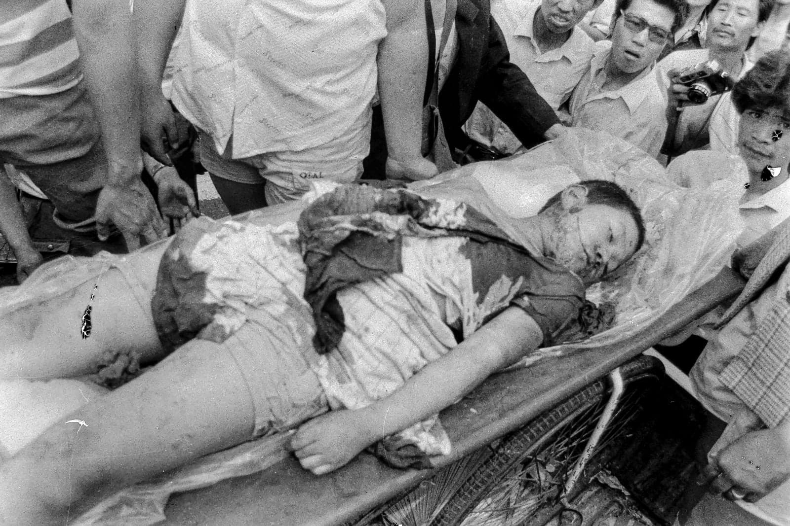 <em>Advertencia: Imagen sensible</em>.<br/>Un hombre yace en una camilla tras el ataque del ejército chino contra los manifestantes en la plaza de Tiananmen en Beijing en junio de 1989.
