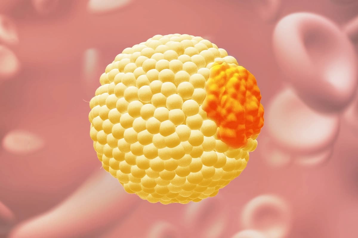 La apolipoproteína B es la proteína naranja que se encuentra en el lado derecho del transportador amarillo de colesterol. (The Epoch Times/Shutterstock).