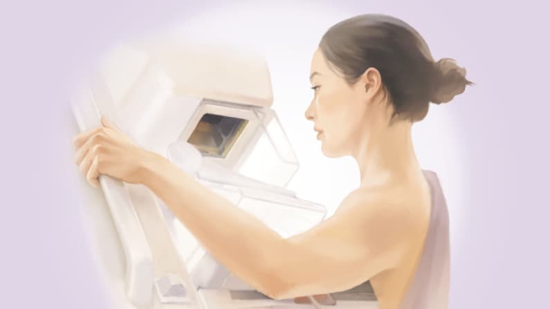 Mamografía: Datos clave sobre la principal prueba de detección del cáncer de mama