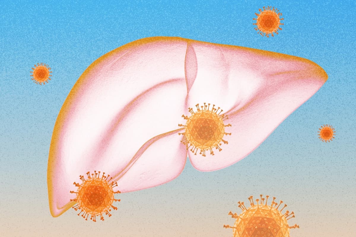 Nuevo medicamento promete cura para la hepatitis B crónica. (Ilustración de The Epoch Times, Shutterstock).