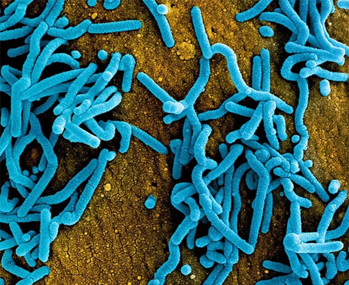 Una micrografía electrónica de barrido coloreada muestra partículas del virus de Marburgo. (NIAID vía The Epoch Times).