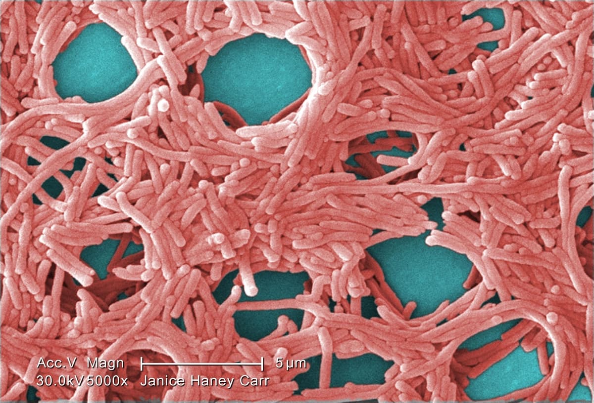 Micrografía electrónica de barrido (SEM) coloreada de la bacteria Legionella pneumophila. (Janice Haney Carr/CDC/Dominio público)