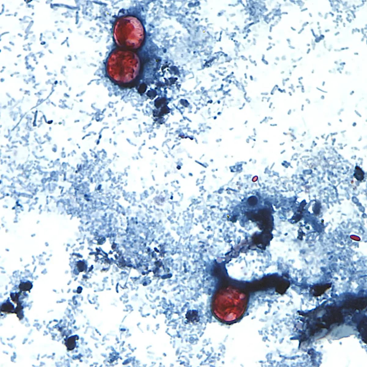 Esta fotografía sin fecha, tomada a través de un microscopio cedido por los CDC, muestra oocistos de Cyclospora cayetanensis encontrados en una muestra de heces frescas, que había sido preparada con una solución de formalina y teñida con safranina. (CDC vía AP).