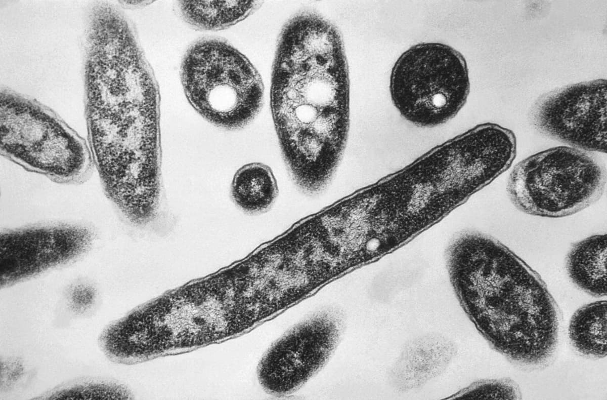 Esta imagen tomada con microscopio electrónico en 1978, facilitada por los Centros para el Control y la Prevención de Enfermedades (CDC), muestra la bacteria Legionella pneumophila, responsable de causar la enfermedad del legionario. (Francis Chandler/CDC vía AP)