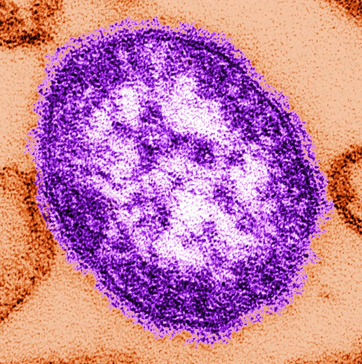 Una imagen sin fecha, facilitada por los Centros para el Control y la Prevención de Enfermedades (CDC) el 4 de febrero de 2015, muestra una imagen tomada con microscopio electrónico de una partícula del virus del sarampión. (Cynthia Goldsmith/Centros para el Control y la Prevención de Enfermedades vía AP).