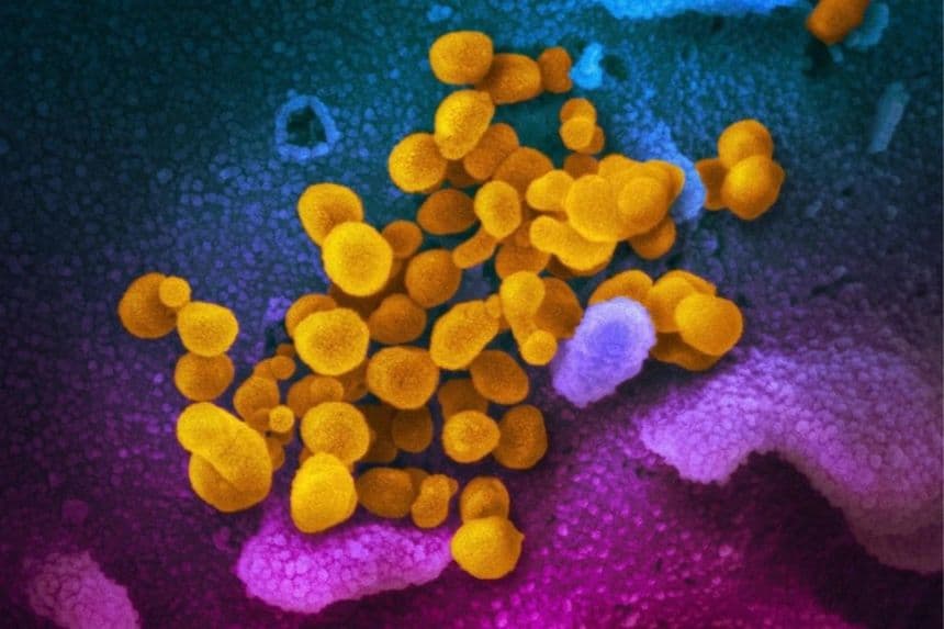 Esta imagen de microscopio electrónico sin fecha, facilitada por los Institutos Nacionales de Salud de EE. UU. en febrero de 2020, muestra el nuevo coronavirus SARS-CoV-2, en amarillo, emergiendo de la superficie de las células, en azul/rosa, cultivadas en el laboratorio. También conocido como 2019-nCoV, el virus causa la COVID-19. (NIAID-RML/AP/The Canadian Press)
