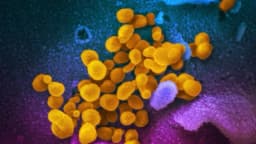 Pandemia de COVID aceleró envejecimiento cerebral incluso en personas que no tuvieron el virus: estudio