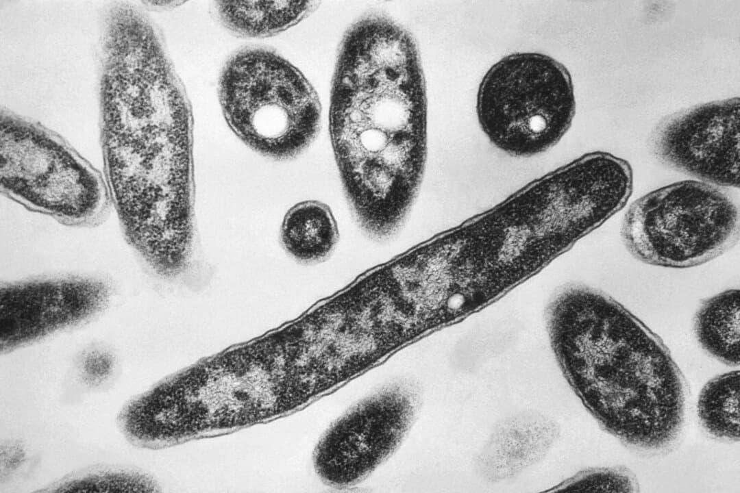 Bacteria Legionella pneumophila en una imagen tomada con un microscopio electrónico en 1978. (Francis Chandler/CDC a través de AP.)
