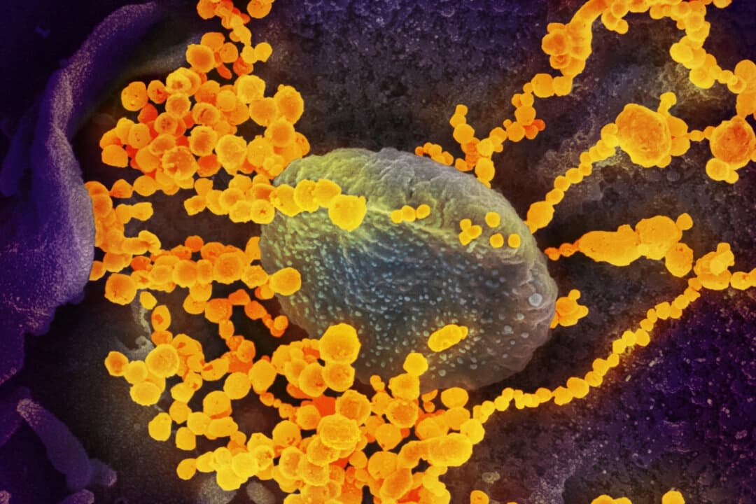 Una imagen de microscopio electrónico muestra el SARS-CoV-2 (objetos redondos de oro), causante de COVID-19, emergiendo de células cultivadas. (NIAID vía The Epoch Times9