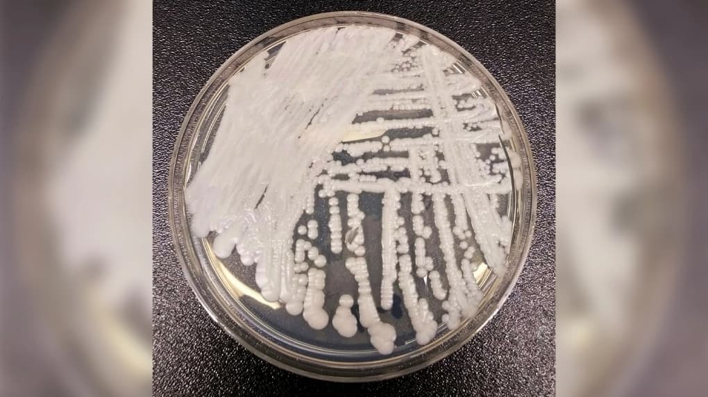 Una fotografía sin fecha del Centro para el Control y la Prevención de Enfermedades muestra una cepa de Candida auris cultivada en una placa de Petri en un laboratorio del CDC. (The Canadian Press/Shawn Lockhart-CDC vía AP)