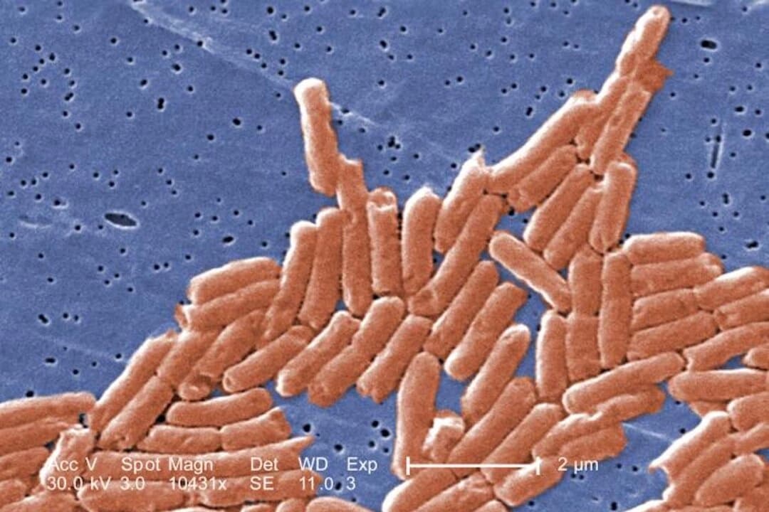 Imagen coloreada digitalmente mediante microscopio electrónico de barrido de un grupo de bacilos gramnegativos, o bacterias con forma de bastón, de Salmonella sp. (Janice Haney Carr/CDC)
