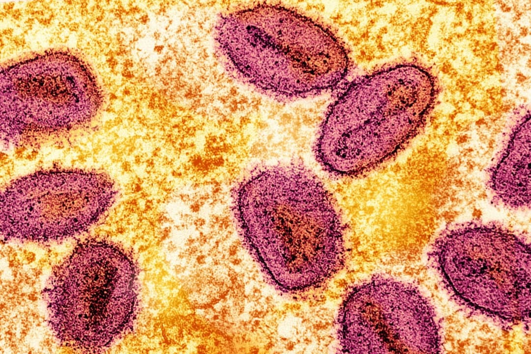 Micrografía electrónica de transmisión coloreada sin fecha de partículas del virus del mpox (rosa) encontradas dentro de una célula infectada (amarilla), cultivadas en el laboratorio, capturada en el Instituto Nacional de Alergias y Enfermedades Infecciosas (NIAID) Centro de Investigación Integrada (IRF) en Fort Detrick, Maryland. (NIAID/Handout vía Reuters)