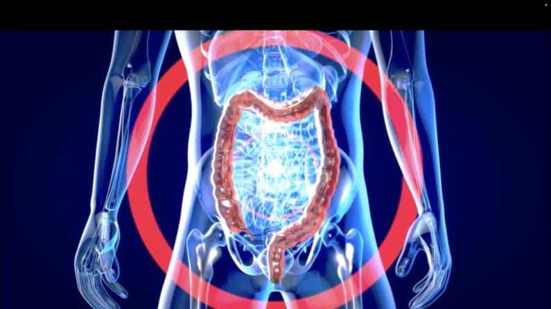 ¡Cuida tu metabolismo! si no funciona correctamente podría provocar una enfermedad crónica