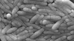 CDC alerta: Brote de salmonela en niños por camaleones domésticos