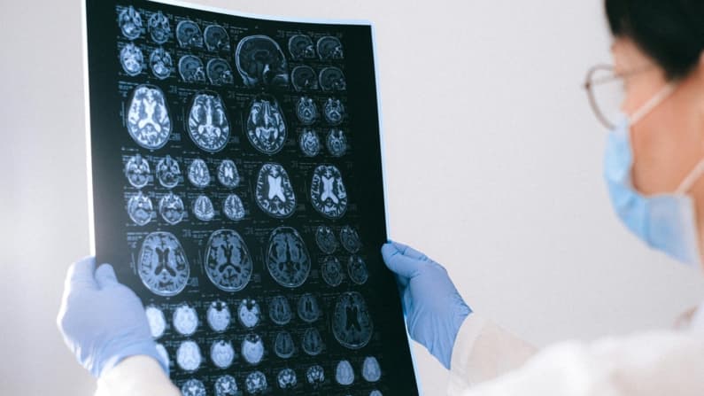 Una bacteria común podría empeorar el Alzheimer