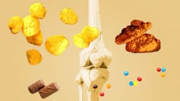 Relacionan alimentos ultraprocesados con huesos más débiles y mayor riesgo de fracturas: estudio